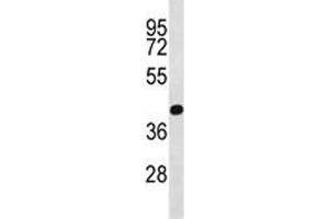 PRMT6 antibody  (AA 19-48)