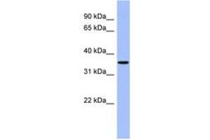anti-Protein Phosphatase, Mg2+/Mn2+ Dependent, 1A (PPM1A) (AA 107-156) antibody