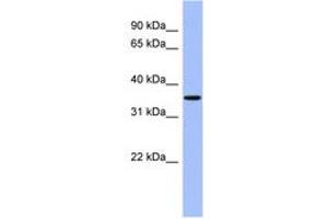 Image no. 1 for anti-Protein Phosphatase, Mg2+/Mn2+ Dependent, 1A (PPM1A) (AA 107-156) antibody (ABIN6744214) (PPM1A antibody  (AA 107-156))