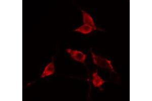 ABIN6274753 staining Hela cells by IF/ICC.
