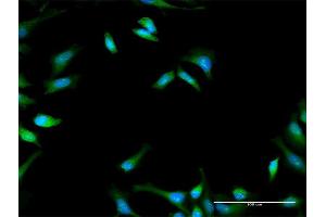 Immunofluorescence of purified MaxPab antibody to PFKFB1 on HeLa cell. (PFKFB1 antibody  (AA 1-471))