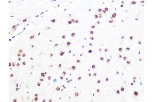 Immunohistochemistry (IHC) image for anti-Damage Specific DNA Binding Protein 1 (DDB1) antibody (ABIN7266673)