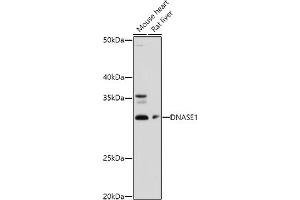 Western blot analysis of extracts of various cell lines, using DN antibody (ABIN3016214, ABIN3016215, ABIN3016216, ABIN1679557 and ABIN6219627) at 1:1000 dilution.