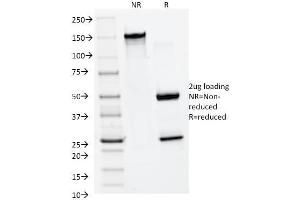 SDS-PAGE Analysis Purified MMP2 Monoclonal Antibody (MMP2/1501). (MMP2 antibody  (AA 444-575))