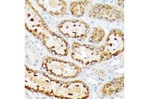 Immunohistochemistry of paraffin-embedded rat kidney using ENTPD5 Rabbit mAb (ABIN7266895) at dilution of 1:100 (40x lens). (ENTPD5 antibody)