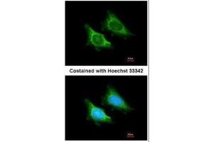 ICC/IF Image Immunofluorescence analysis of methanol-fixed HeLa, using MRPS5, antibody at 1:200 dilution. (MRPS5 antibody)