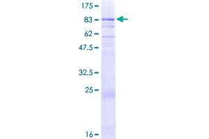 Image no. 1 for NIMA related kinase 3 (NEK3) (AA 1-506) protein (GST tag) (ABIN1312358) (NEK3 Protein (AA 1-506) (GST tag))