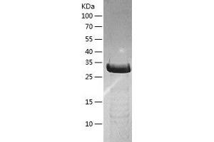 Western Blotting (WB) image for Protein Arginine Methyltransferase 1 (PRMT1) (AA 1-361) protein (His tag) (ABIN7124642) (PRMT1 Protein (AA 1-361) (His tag))