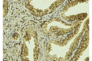ABIN6276526 at 1/100 staining Mouse colon tissue by IHC-P.