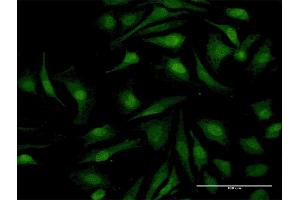 Immunofluorescence (IF) image for anti-V-Rel Reticuloendotheliosis Viral Oncogene Homolog B (RELB) (AA 1-579) antibody (ABIN948396)