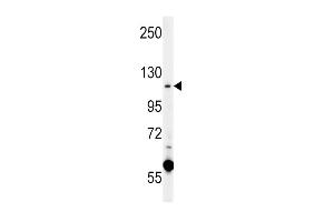 CACNA2D4 antibody  (N-Term)
