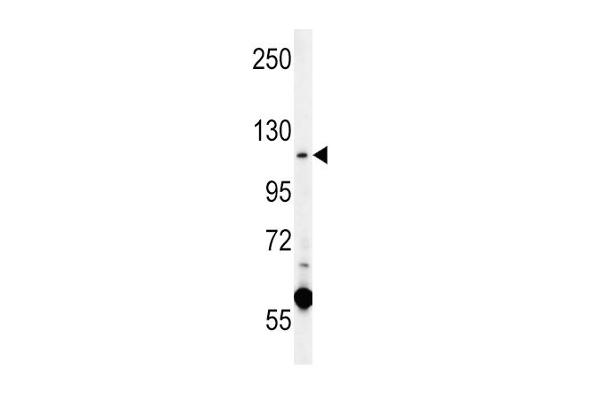 CACNA2D4 antibody  (N-Term)