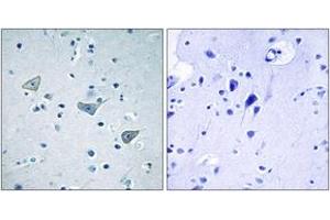Immunohistochemistry analysis of paraffin-embedded human brain tissue, using GPR158 Antibody. (GPR158 antibody  (AA 1-50))