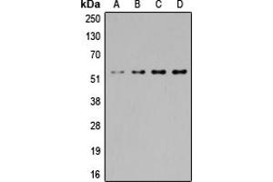 Western blot analysis of SGK1/2 expression in Jurkat (A), HeLa (B), NIH3T3 (C), PC12 (D) whole cell lysates. (SGK1/2 (Center) antibody)