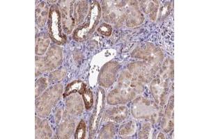 Immunohistochemical staining of human kidney with COX20 polyclonal antibody  shows strong cytoplasmic positivity in subset of renal tubules at 1:50-1:200 dilution.