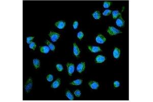 IF analysis of ALPP using anti- ALPP antibody (ABIN4886453). (PLAP antibody  (C-Term))