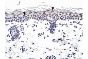Image no. 1 for anti-Zinc Finger Protein 223 (ZNF223) (AA 95-144) antibody (ABIN6735983) (ZNF223 antibody  (AA 95-144))