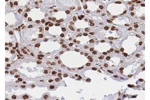 ABIN6268824 at 1/100 staining human kidney tissue sections by IHC-P. (HNRNPM antibody  (N-Term))