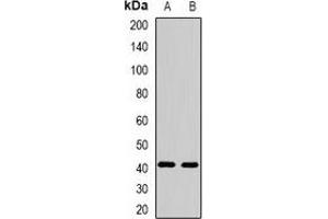 Western blot analysis of FBXO32 expression in mouse heart (A), mouse skeletal muscle (B) whole cell lysates.