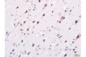 Paraformaldehyde-fixed, paraffin embedded rat brain, Antigen retrieval by boiling in sodium citrate buffer (pH6. (Golgin B1 (GOLGB1) (AA 751-850) antibody)