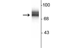 Western Blotting (WB) image for anti-Synapsin I (SYN1) antibody (ABIN361409)