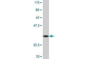 Western Blot detection against Immunogen (36. (SFXN3 antibody  (AA 1-100))