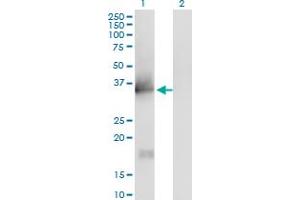 Western Blot analysis of IL1A expression in transfected 293T cell line by IL1A monoclonal antibody (M01), clone 4B8. (IL1A antibody  (AA 172-271))