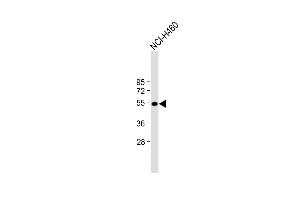 Anti-T Antibody (N-term) at 1:2000 dilution + NCI- whole cell lysate Lysates/proteins at 20 μg per lane.