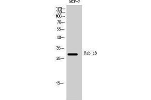 Western Blotting (WB) image for anti-RAB18, Member RAS Oncogene Family (RAB18) (Internal Region) antibody (ABIN3186613)
