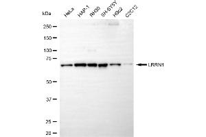 anti-Leucine Rich Repeat Neuronal 1 (LRRN1) antibody