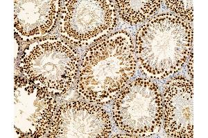ABIN7095890 and ABIN7099952 at 1/100 staining rat testis tissue by IHC-P. (GRHL2 antibody)