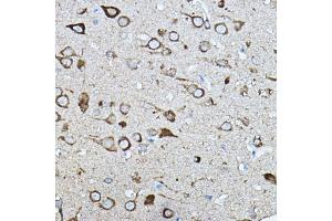 Immunohistochemistry of paraffin-embedded rat brain using KI Rabbit pAb (ABIN7271349) at dilution of 1:100 (40x lens). (Strumpellin antibody  (AA 380-530))