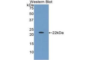 Detection of Recombinant IGFBP1, Cattle using Polyclonal Antibody to Insulin Like Growth Factor Binding Protein 1 (IGFBP1) (IGFBPI antibody  (AA 112-263))