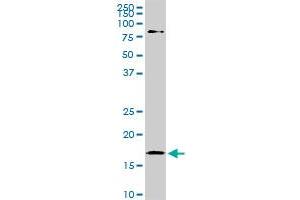 Western Blotting (WB) image for anti-Cofilin 1 (CFL1) (AA 1-167) antibody (ABIN598606) (Cofilin antibody  (AA 1-167))
