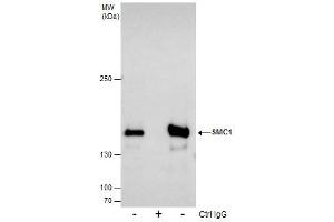 IP Image Immunoprecipitation of SMC1A protein from 293T whole cell extracts using 5 μg of SMC1A antibody [N1N2], N-term, Western blot analysis was performed using SMC1A antibody [N1N2], N-term, EasyBlot anti-Rabbit IgG  was used as a secondary reagent.