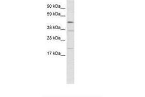 Image no. 1 for anti-TEA Domain Family Member 1 (SV40 Transcriptional Enhancer Factor) (TEAD1) (N-Term) antibody (ABIN202462) (TEAD1 antibody  (N-Term))