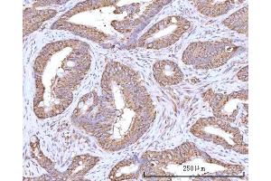 IHC analysis of RPN1 using anti-RPN1 antibody (ABIN7600447). (RPN1 antibody  (AA 196-495))