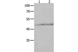 Western Blot analysis of Jurkat and K562 cell using NCK1 Polyclonal Antibody at dilution of 1:600 (NCK1 antibody)