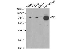 Western blot analysis of extracts of various cell lines, using F12 antibody (ABIN5970845) at 1/1000 dilution. (F12 antibody)