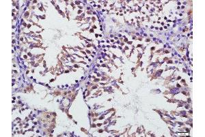 Paraformaldehyde-fixed, paraffin embedded mouse testis, Antigen retrieval by boiling in sodium citrate buffer (pH6) for 15min, Block endogenous peroxidase by 3% hydrogen peroxide for 30 minutes, Blocking buffer (normal goat serum) at 37°C for 20min, Antibody incubation with Mitofusin 1 Polyclonal Antibody, Unconjugated  at 1:400 overnight at 4°C, followed by a conjugated secondary for 20 minutes and DAB staining. (MFN1 antibody  (AA 651-741))