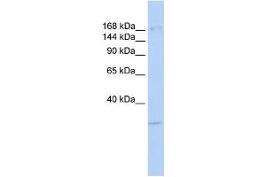 Western Blotting (WB) image for anti-Lysine (K)-Specific Demethylase 6A (KDM6A) antibody (ABIN2458408)