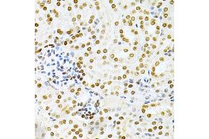 Immunohistochemistry of paraffin-embedded mouse kidney using DKC1 Antibody (ABIN3022640, ABIN3022641, ABIN1512829 and ABIN6218993) at dilution of 1:200 (40x lens). (DKC1 antibody  (AA 245-514))