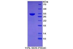 SDS-PAGE (SDS) image for CD109 (CD109) (AA 890-1131) protein (His tag) (ABIN2124356)