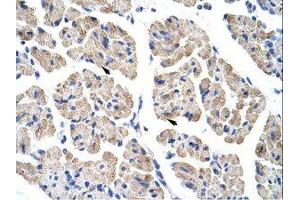 Image no. 1 for anti-T-Cell Leukemia Homeobox 2 (TLX2) (C-Term) antibody (ABIN202158) (TLX2 antibody  (C-Term))