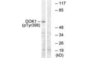 Western blot analysis of extracts from K562 cells treated with Starvation 24h, using p62 Dok (Phospho-Tyr398) Antibody.