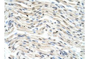 THOC3 antibody was used for immunohistochemistry at a concentration of 4-8 ug/ml to stain Myocardial cells (arrows) in Human Heart.