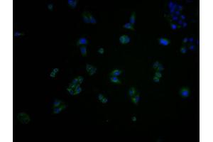 Immunofluorescence staining of Hela cells with ABIN7148898 at 1:100, counter-stained with DAPI. (CDK6 antibody  (AA 102-326))
