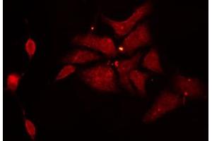 ABIN6272283 staining HeLa by IF/ICC. (CYB561D1 antibody  (C-Term))