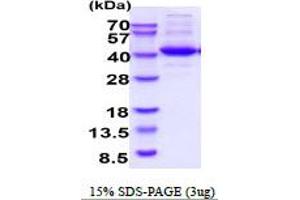 SDS-PAGE (SDS) image for CD90 (THY1) (AA 20-130) protein (His tag) (ABIN6387868)