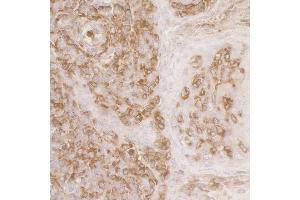 Immunohistochemistry (IHC) image for anti-Actin-Related Protein 2 (ACTR2) (AA 25-75) antibody (ABIN7453417) (ACTR2 antibody  (AA 25-75))